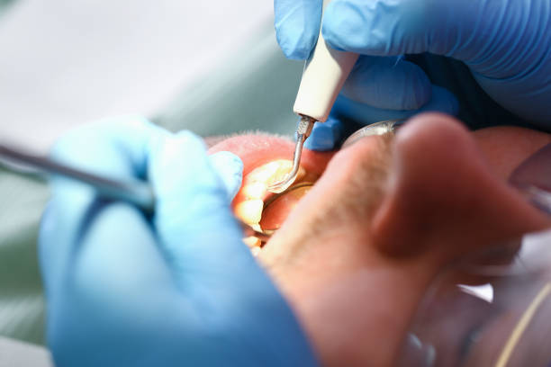 Best Emergency Treatment for Toothache in Wolcottville, IN