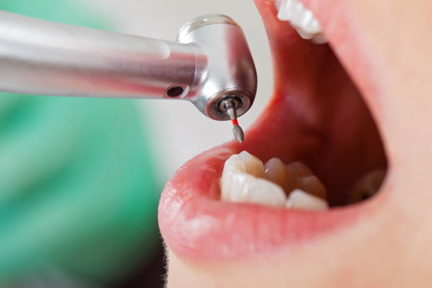 Best Emergency Treatment for Toothache in Wolcottville, IN